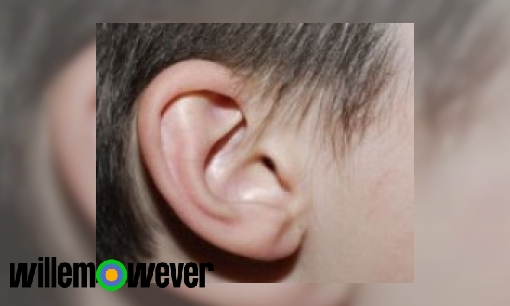 Hoe komt een trommelvliesbuisje in je oren?