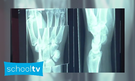 Hoe werkt een röntgenapparaat?
