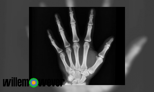 Plaatje Hoe werkt een röntgenfoto?